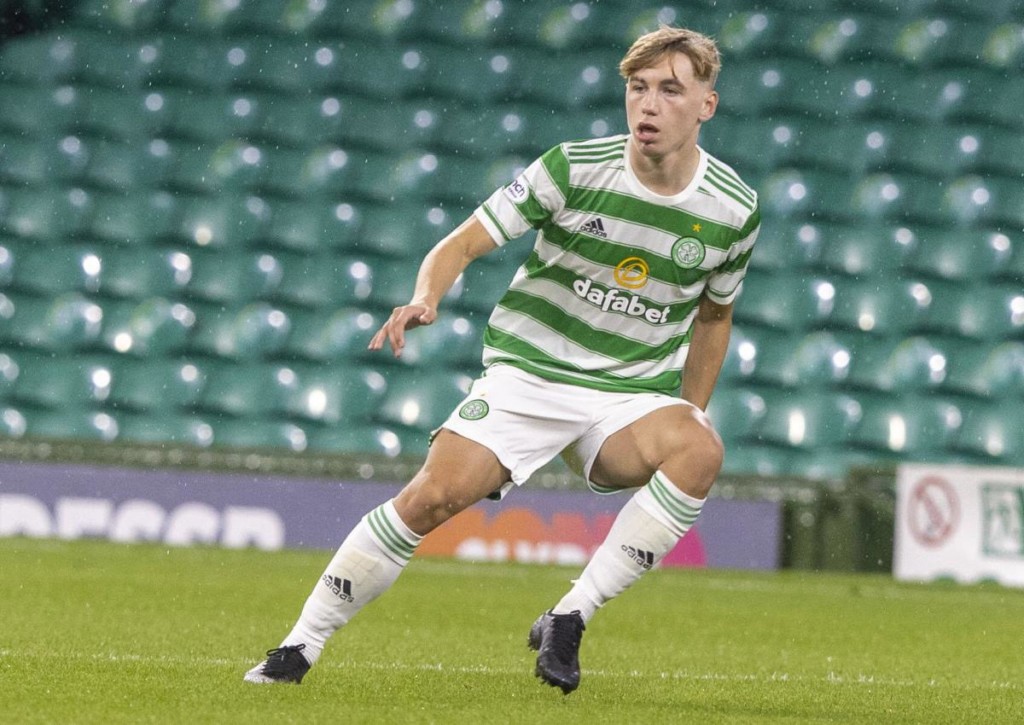 Wie ernst nimmt Celtic Glasgow das Pokalspiel gegen Hearts?