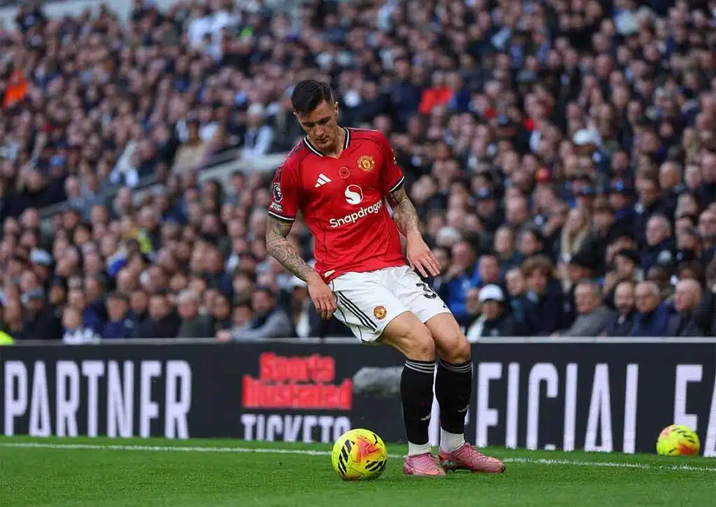 Manchester United Manchester City Tipp