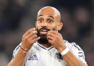 Everton Manchester United Tipp